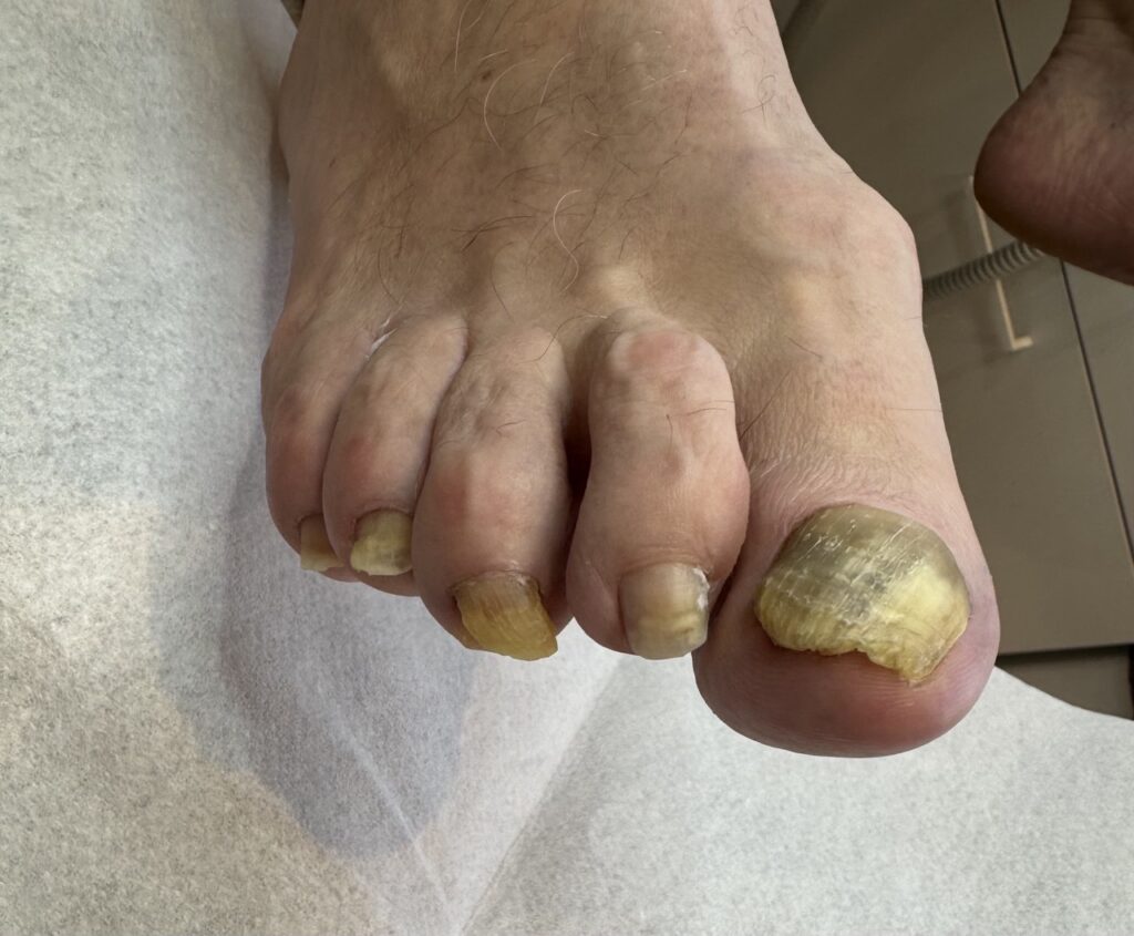 Per kiek laiko atauga nagas?