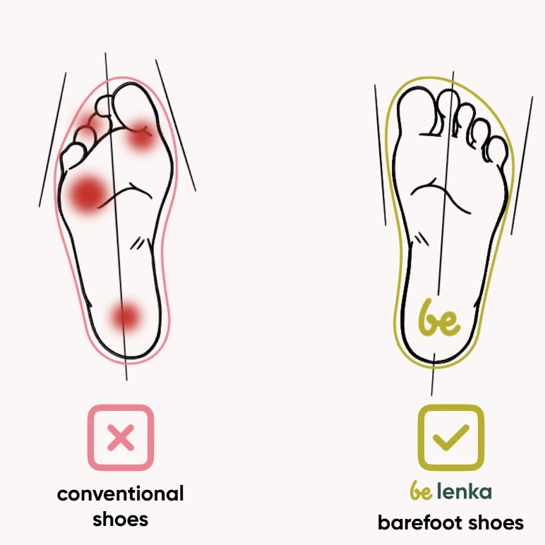 Barefoot batai plačiai pėdai ir esant pėdų problemoms
